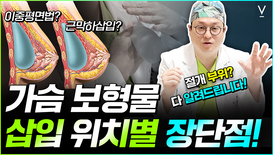 가슴보형물위치별장단점