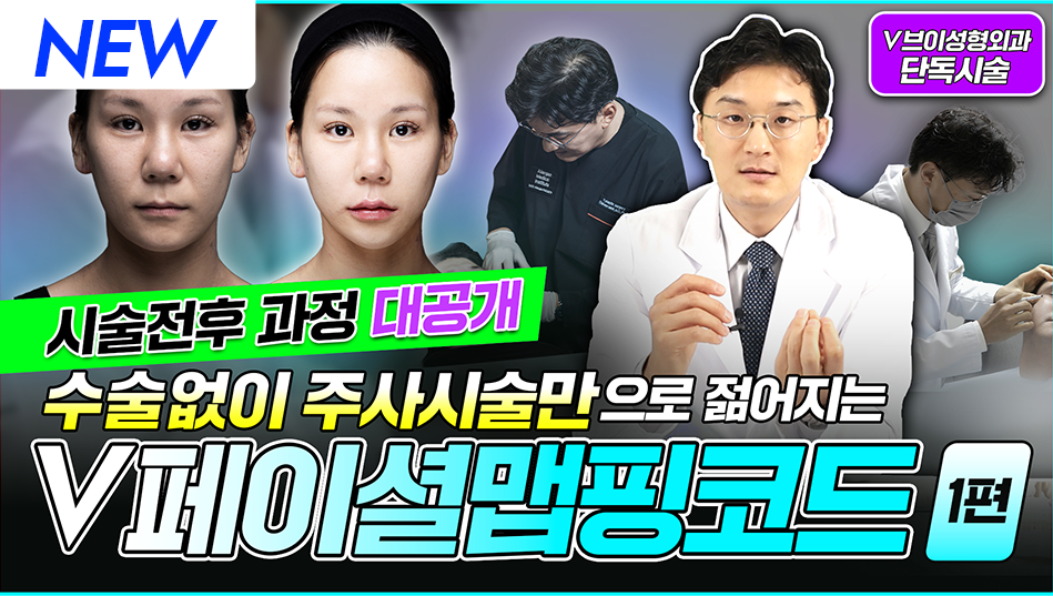 v페이셜맵핑코드 1