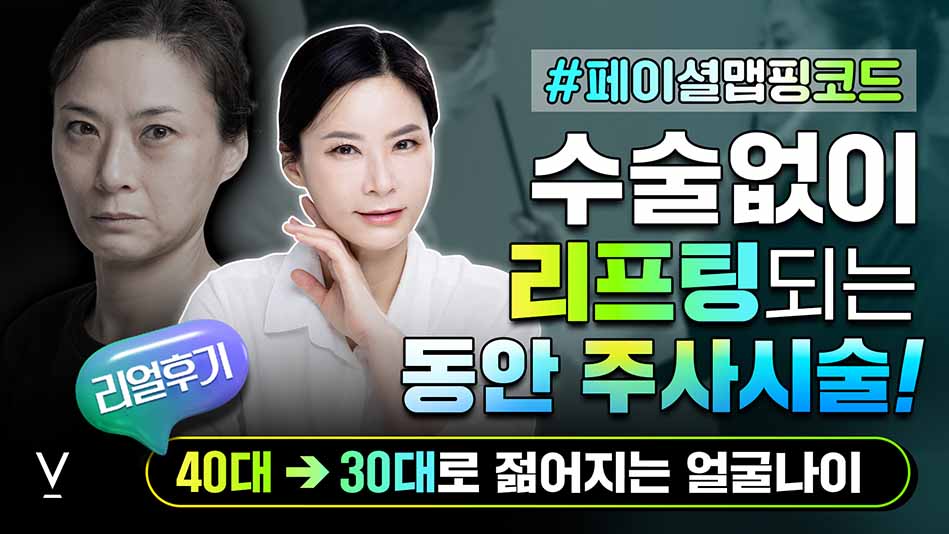 v페이셜맵핑코드 리프팅동안주사시술