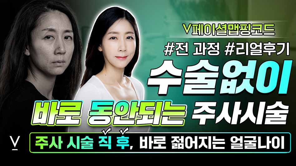 v페이셜맵핑코드 동안주사시술