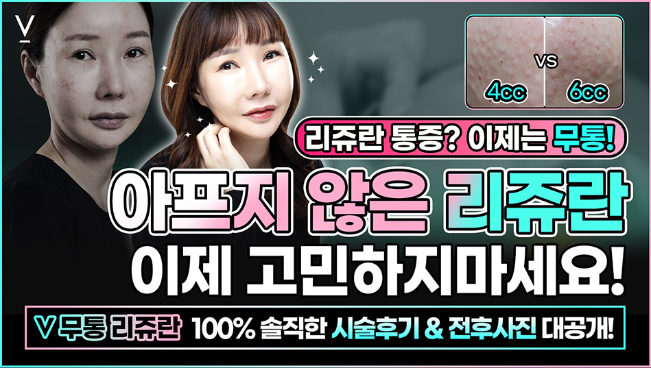 무통리쥬란 시술후기