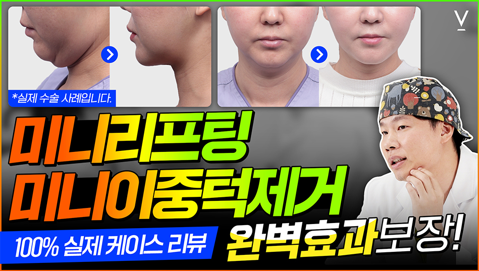 미니리프팅완벽효과