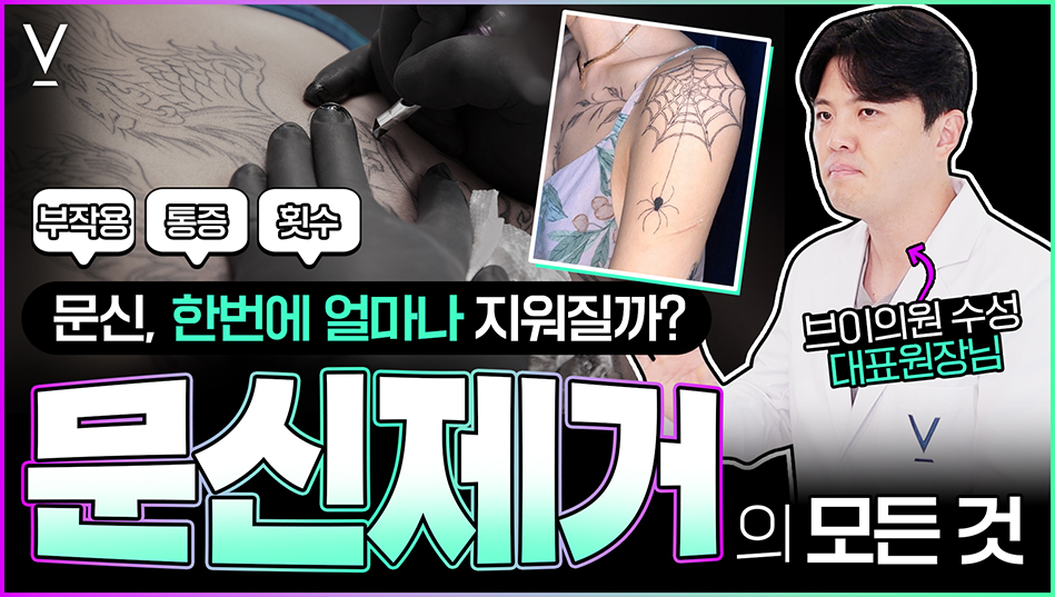 문신제거의 모든것