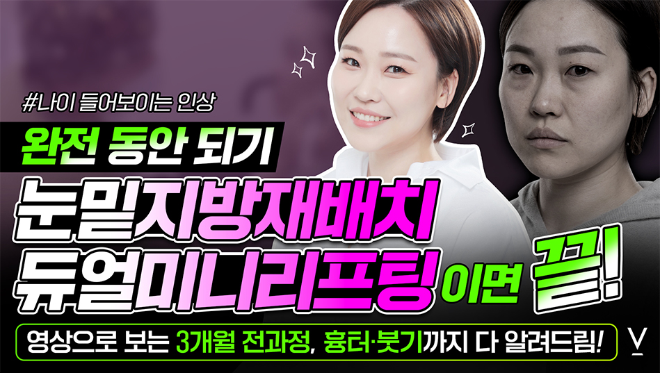 듀얼미니리프팅