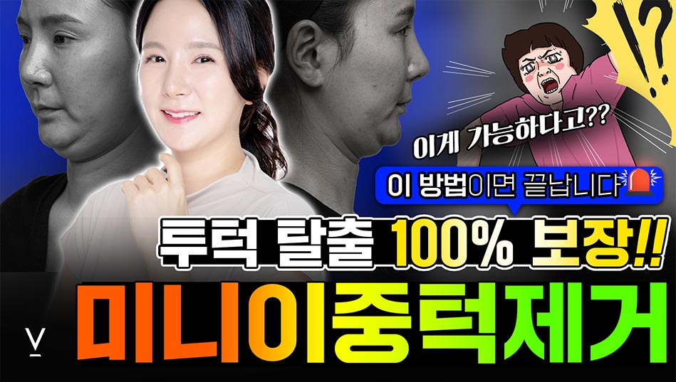 미니이중턱제거