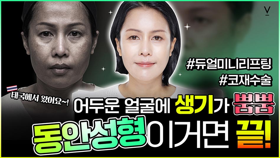 동안성형이거면끝