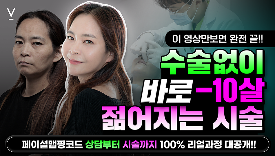 페이셜맵핑코드